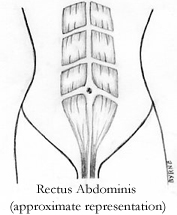 Abdominal Diastasis Recti